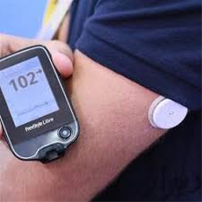 سنسور پایش مداوم قند خون یا CGM